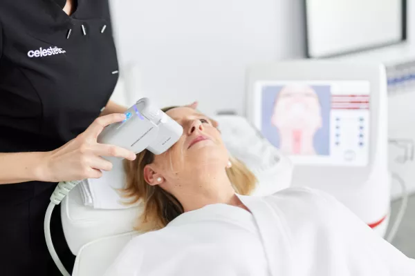 Niet-chirurgische facelift met HIFU